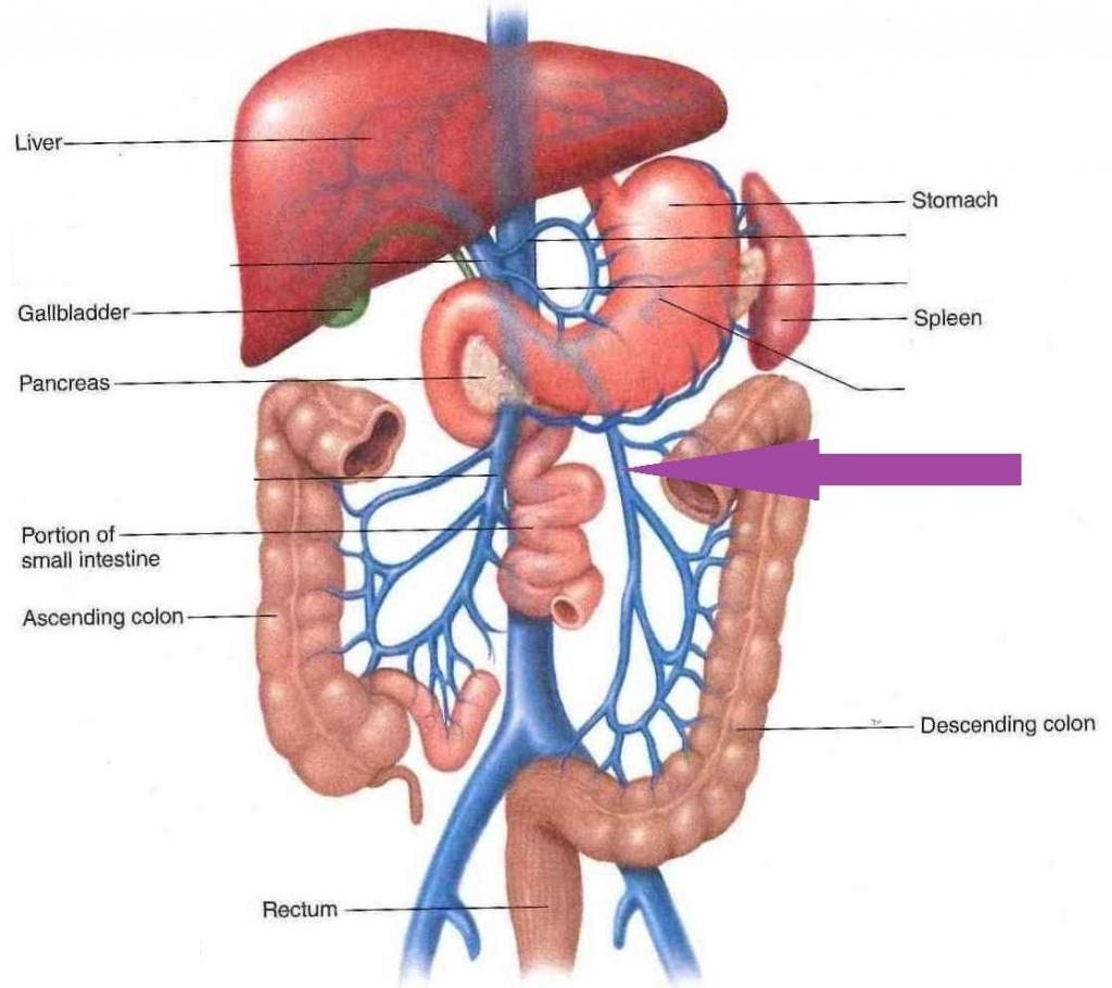 mesenteric-venous-thrombosis-nejm