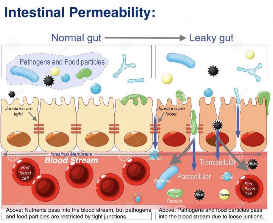 Intestinal-Permeability-3927417703.jpeg